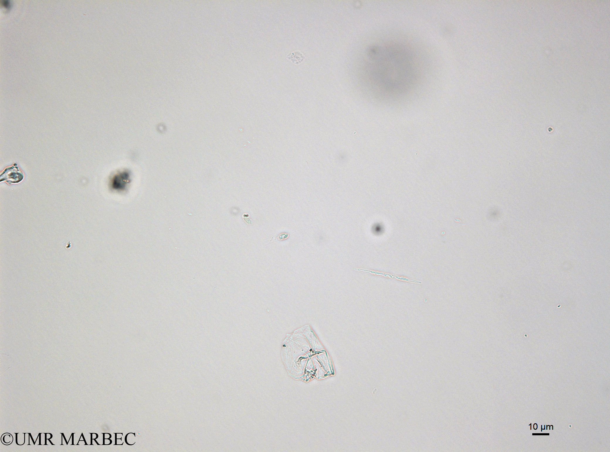 phyto/Bizerte/bizerte_bay/RISCO April 2014/Dinobryon faculiferum (Microflagellé logette141216_001_ovl -5)(copy).jpg
